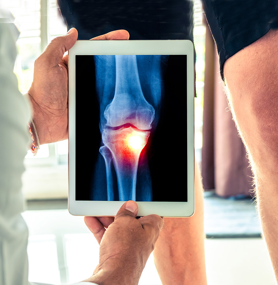 dr. hasham alvi specializes in minimally invasive knee surgery